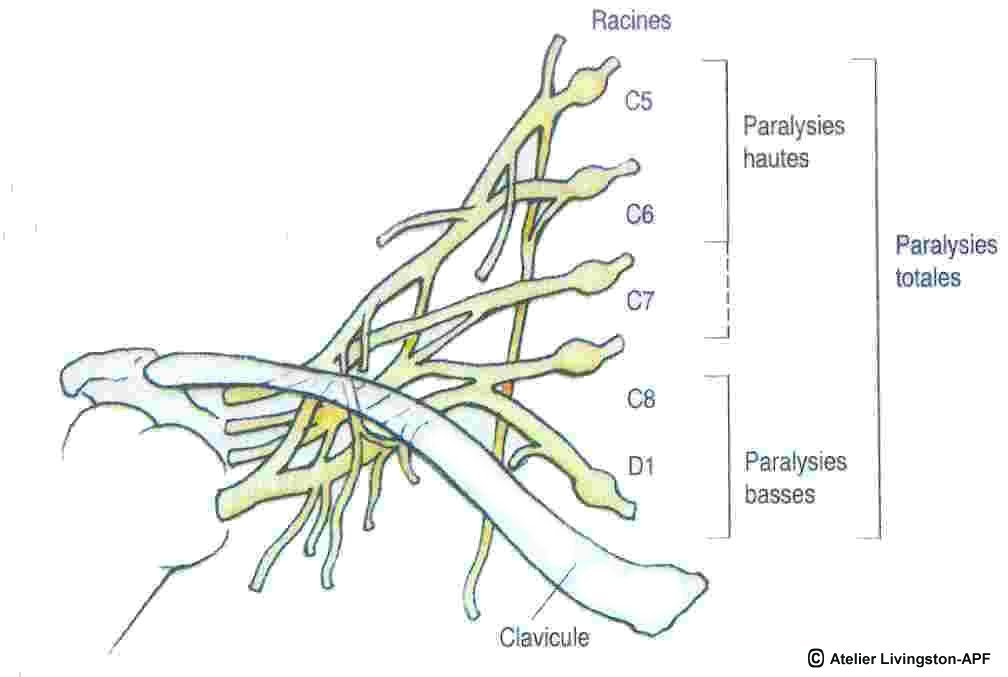 Anatomie - Plexus Brachial 